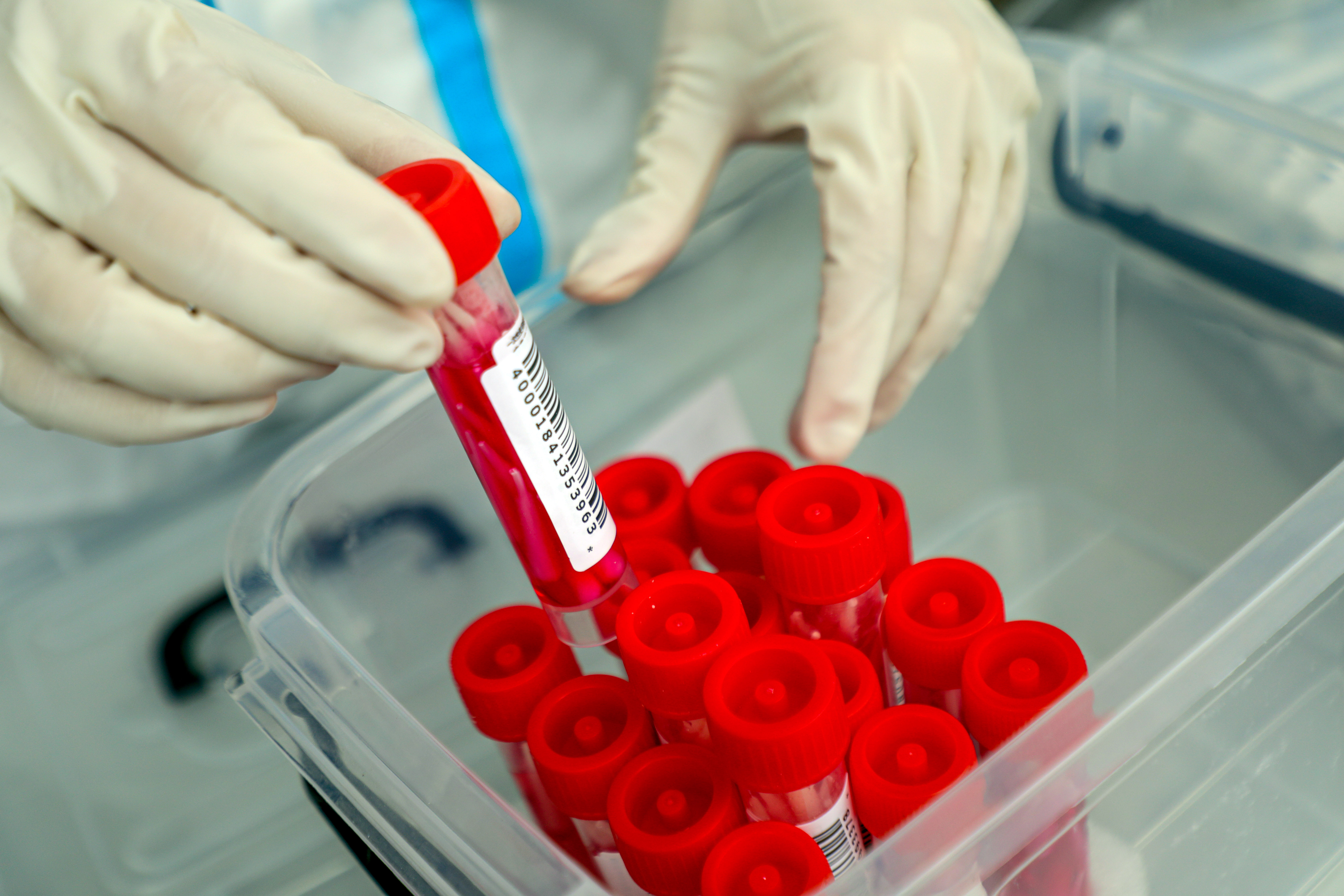 安彩高科:抗疫路上,從來都是“雙向奔赴”!